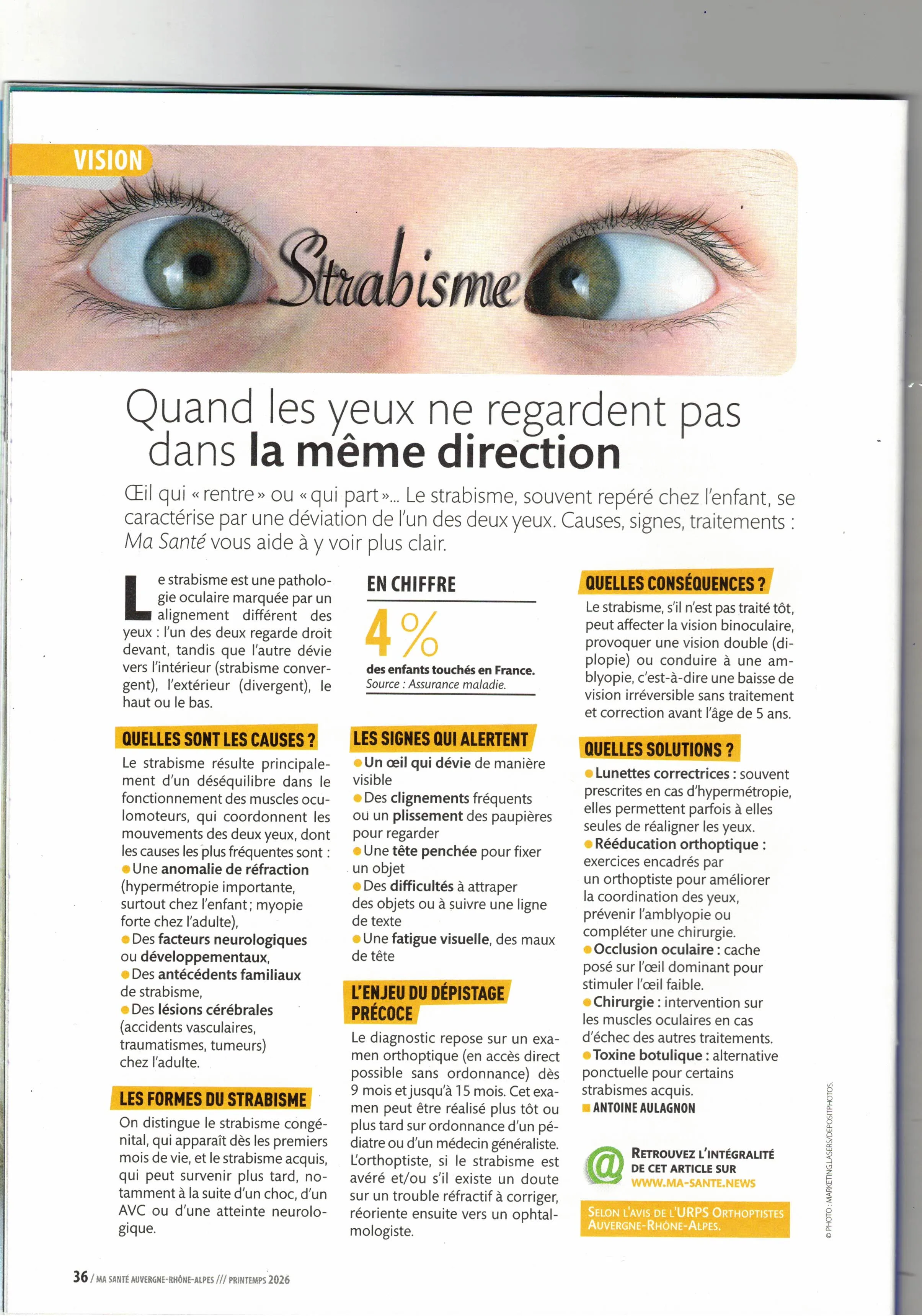 Dépistage du strabisme chez le jeune enfant